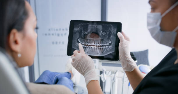 Licensed Teeth Cleaning And Checkup service in Ukiah, CA - Smile Center Dentistry